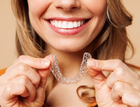 Invisalign - Beautiful Smile