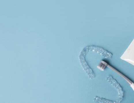 Invisalign Experience