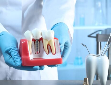 dental implants brisbane