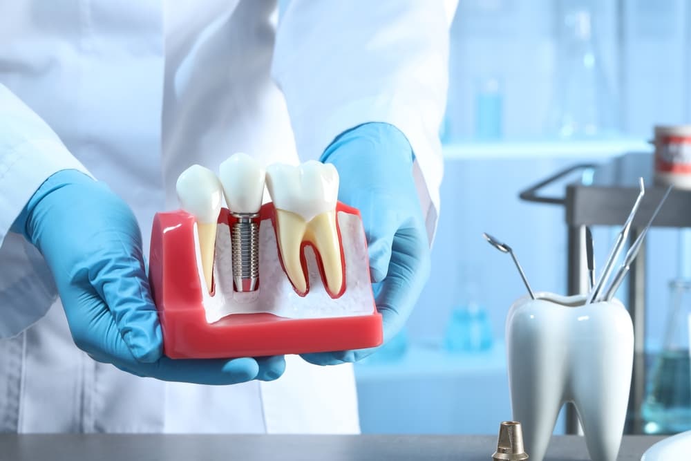 dental implants brisbane