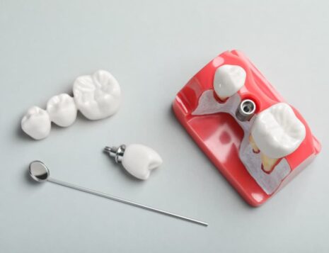 dental implants brisbane